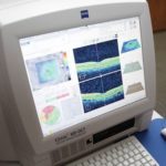 Cataract Surgery NYC | Eye Specialist | Dr. Schottenstein