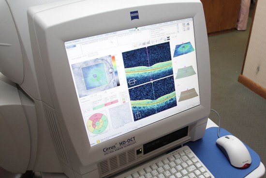 Cataract Surgery NYC | Eye Specialist | Dr. Schottenstein