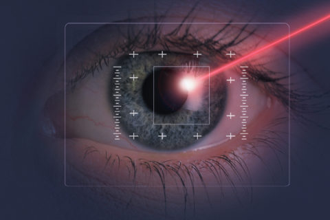 LASIK Eye Surgery FAQs